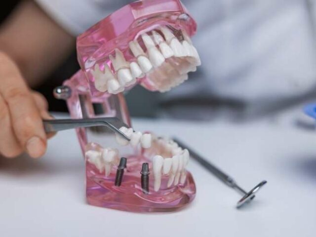 Vacante para implantólogo