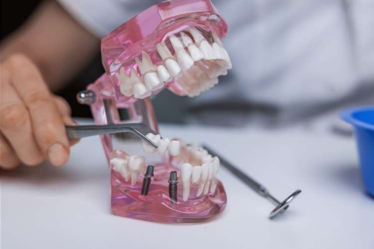 Vacante para implantólogo